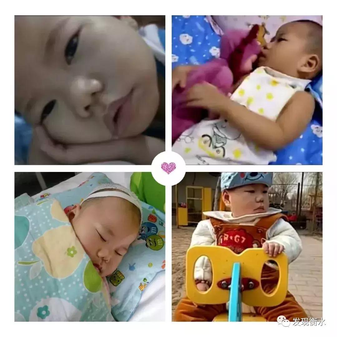 4岁小天使遗体捐赠,捐献眼角膜的小天使