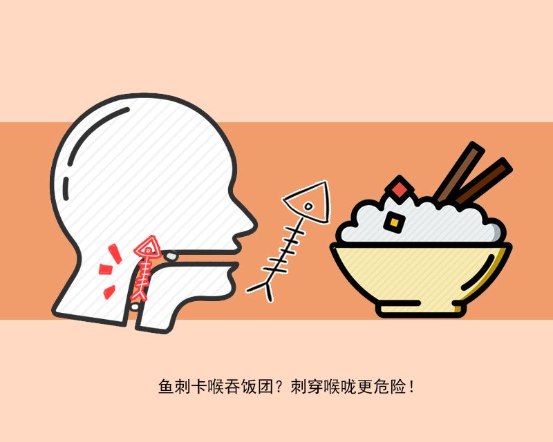 鱼刺卡喉吞饭怎么处理,鱼刺卡喉后喝醋吞饭团
