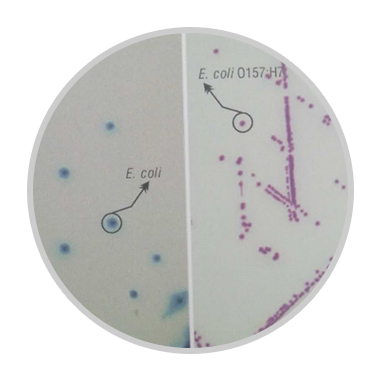 显色培养基教程,显色培养基用途