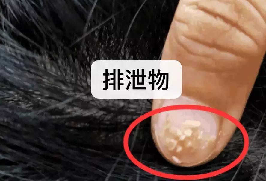 螨虫辟谣大全,你知道螨虫的危害吗涨知识