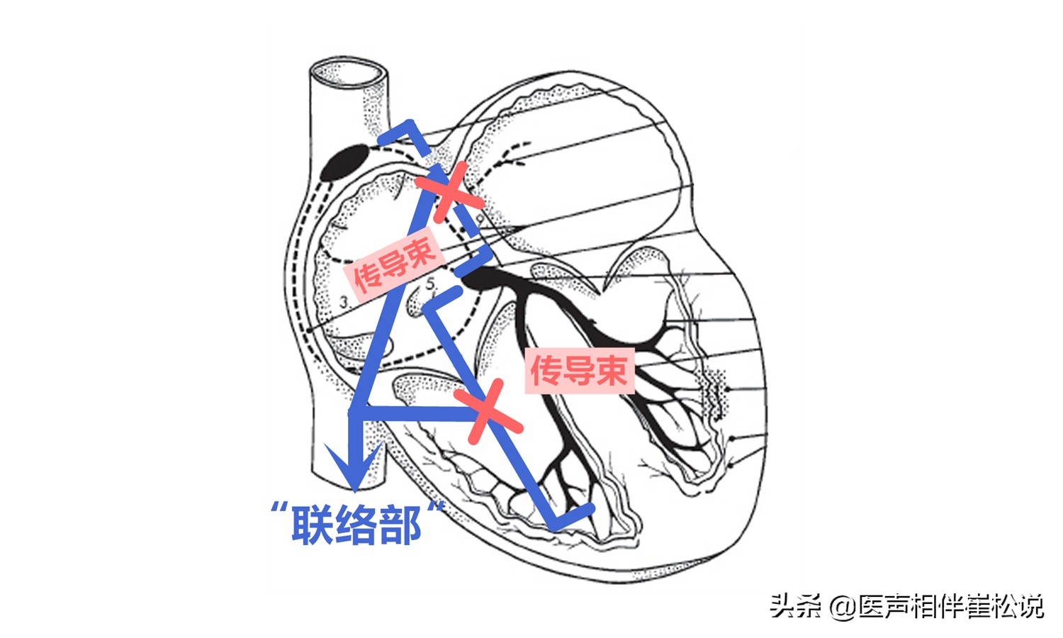 心脏停跳10秒是什么原因引起的,心跳慢心跳骤停怎么办
