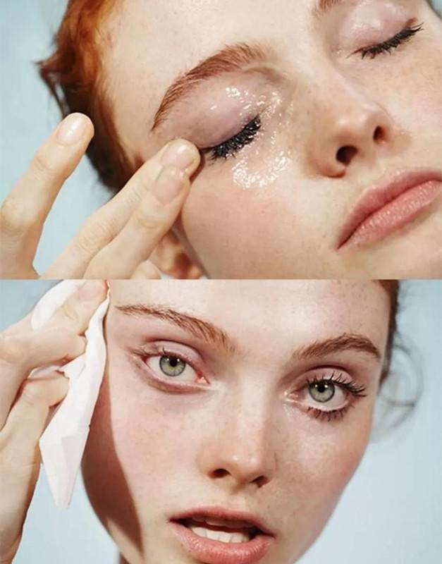 做好清洁有利于祛痘吗,清洁护肤品怎么做的好用