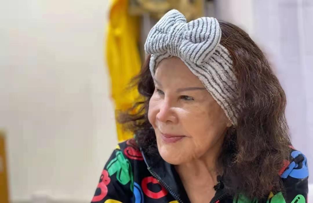 10位被整形毁掉的女星,被整容毁掉的女明星