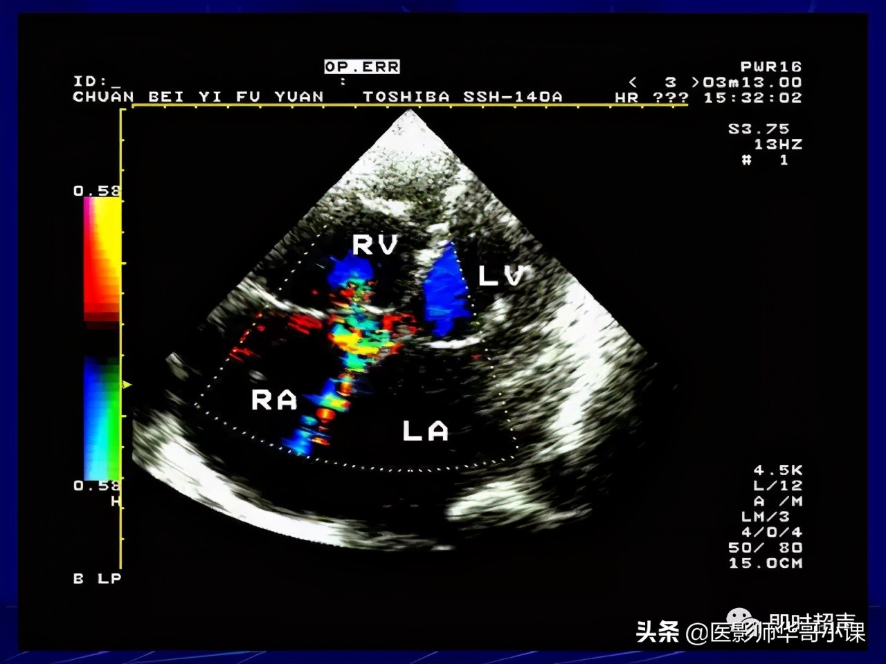 超声检查报告单讲解,超声图像检查