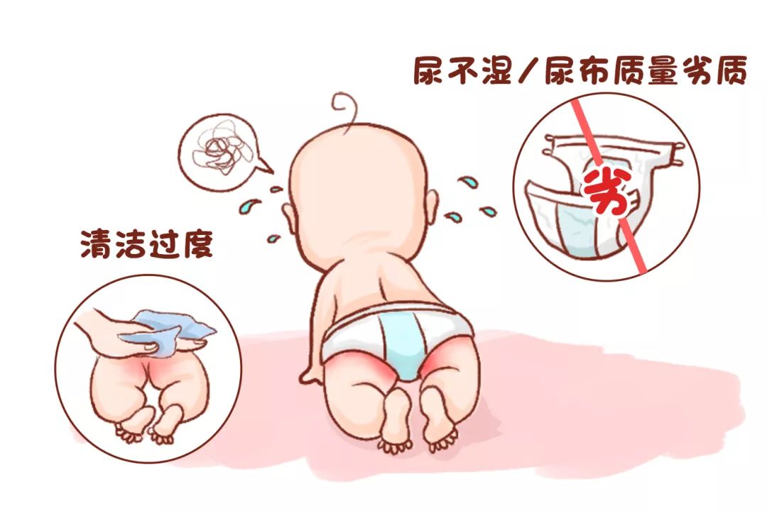 宝宝“红屁股”反反复复?别总让纸尿裤背锅,孕妈护理也有错