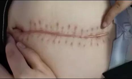 杨丽萍为什么不能生育,杨丽萍回应不生孩子争议