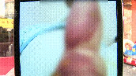 小孩在店里被烫伤要赔多少钱,母婴店洗澡被烫着的孩子