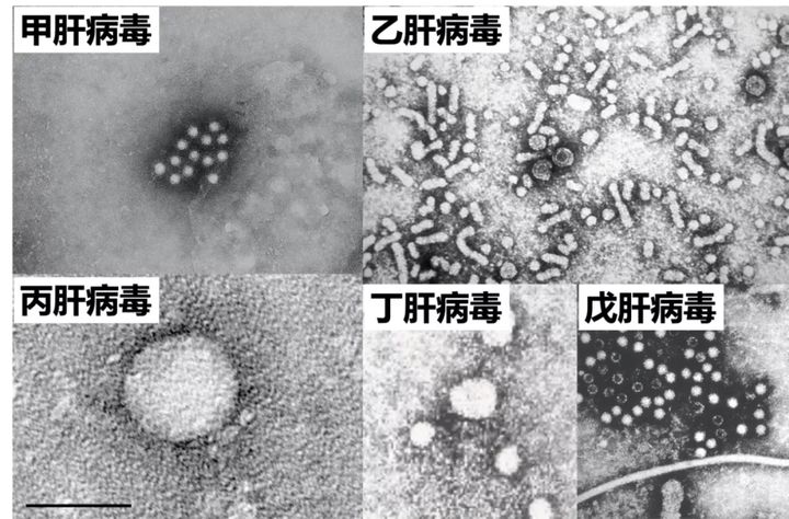 海关截获4米眼镜蛇活体,墨脱眼镜王蛇被咬一口有多毒