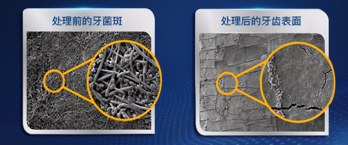 春季唇妆,唇妆不好看