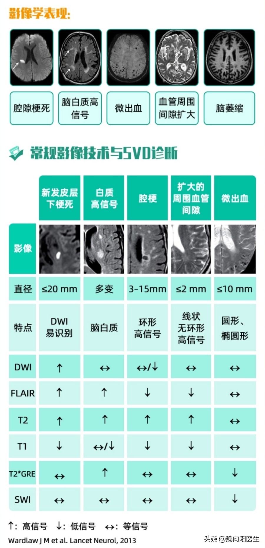 缺血性卒中腔隙性脑梗死,检查结果是腔隙性脑梗死严重吗