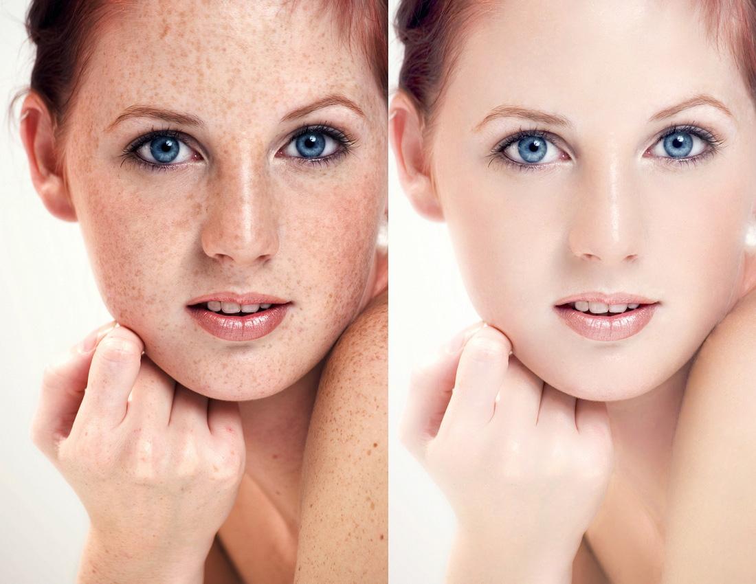 被晒黑了吃什么水果变白,一到夏天就晒黑的小妙招