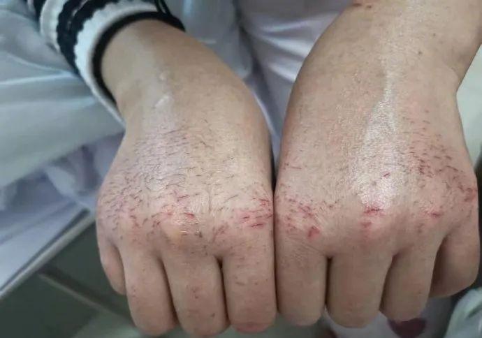 护士节护士有什么福利,护士节感谢家人的话