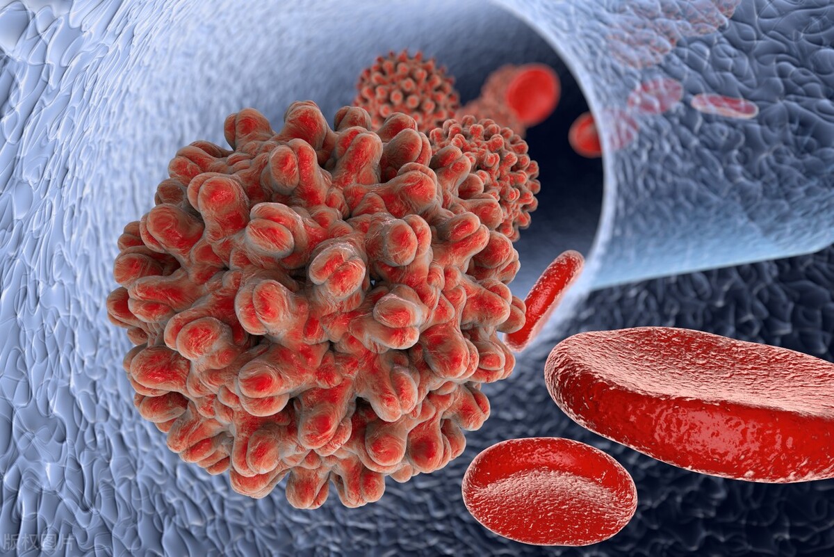 肝癌晚期胃胀怎么缓解,肝癌晚期感觉胃胀是严重了吗