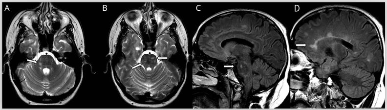 一文读懂13种最常见癌症筛查攻略,一文读懂5大慢性炎症检测项目