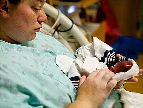 孕晚期引产胎儿是活的吗,引产的胎儿在肚子里的过程