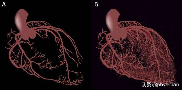 冠心病造影不严重的话怎么治疗,冠心病造影难受吗