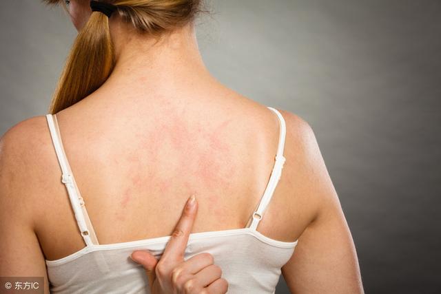 螨虫最怕的是什么办法,让螨虫远离你的简单方法