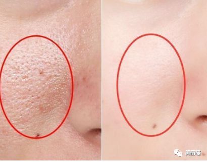 改善毛孔粗大的老牌国货,细化毛孔美白大牌测评