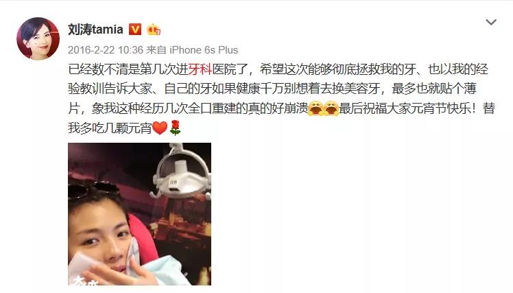 雅悦齿科烤瓷牙视频,明星都做了全烤瓷牙吗