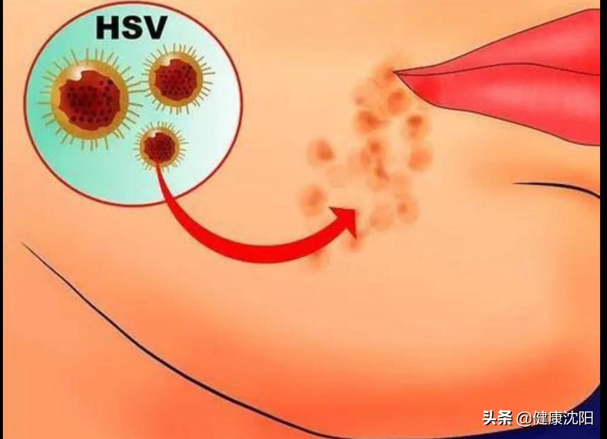 健康科普堂得了流感不要怕,健康科普堂皮肤常见的恶性肿瘤