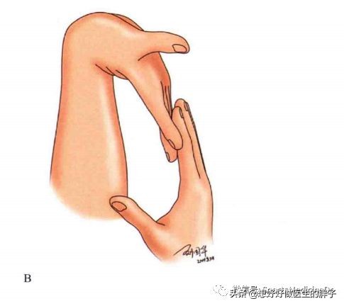 女生韧带硬是什么原因,韧带松弛什么症状儿童