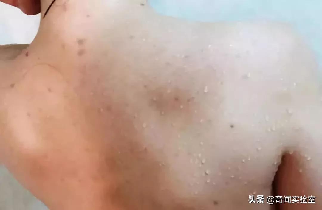 洗澡后背自己洗不掉怎么办,洗澡后背搓不到泥怎么回事