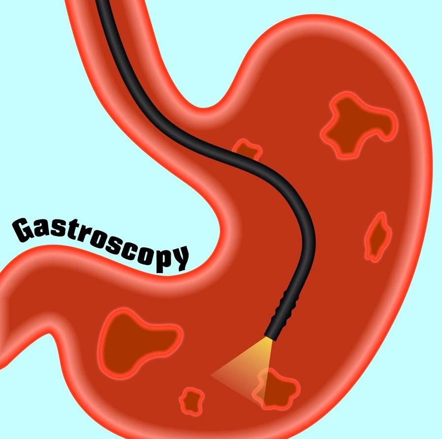 很多人会排斥胃镜对胃镜产生恐惧,纤维胃镜与普通胃镜哪一个难受