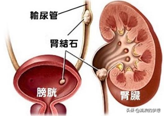 肾虚腰痛怎么锻炼,男人肾虚腰痛吃什么药调理