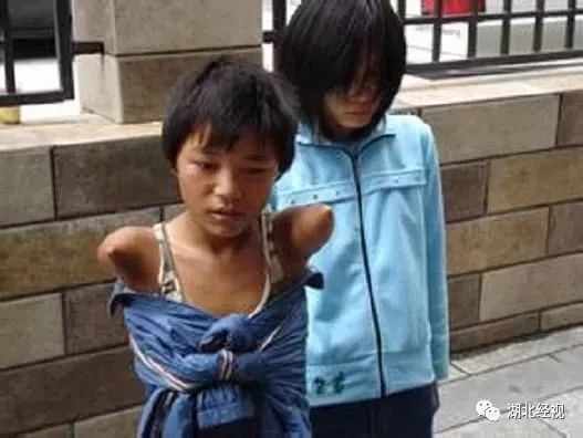 孩子被拐走挖器官案例,眼球被挖了还能接回去吗