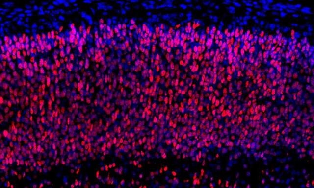 大脑皮层的进化历程,大脑神经元的成长过程
