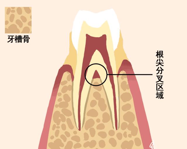 一颗牙齿的动画图片,牙齿脱落过程图解