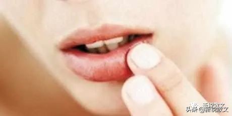 食指无缘无故肿了还痒,食指莫名其妙开裂