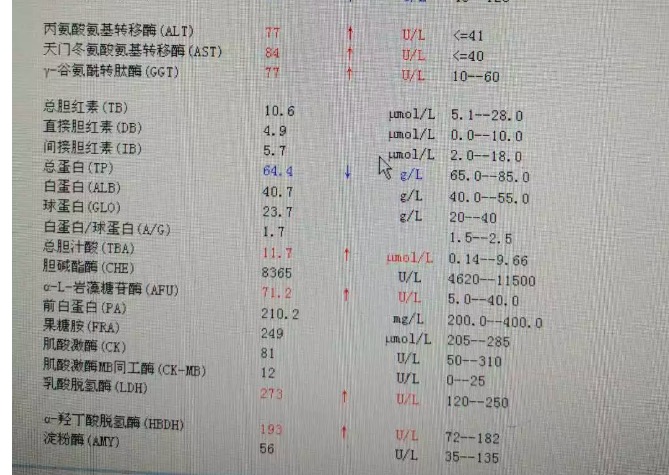 简单易懂30s教你看懂肝功能化验单,教你一招快速读懂肝功能化验单