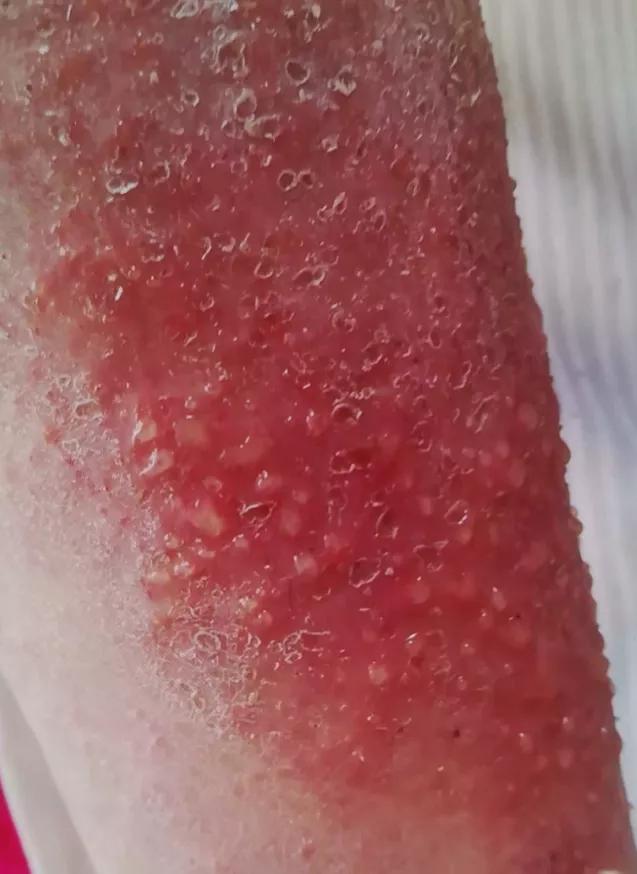 璋﹀窛涓尰,鏉窞璋﹀窛涓尰