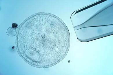 试管婴儿移植后剩余的胚胎怎么办,试管婴儿移植成功后会一直腹胀吗