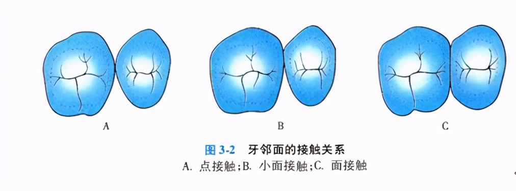 牙齿缺损修复去哪家牙科医院,牙科门牙缺损修复照片