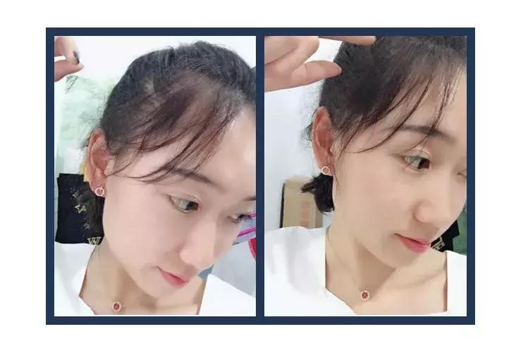 脸大头发卷发际线高怎么化妆,方圆脸脸大戴眼镜怎么化妆好看