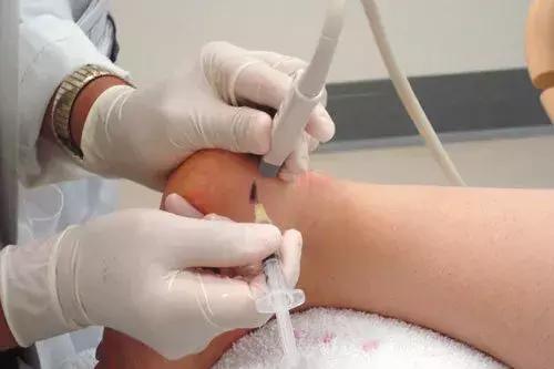 喹诺酮药物（工业合成抗生素）会引起跟腱断裂吗？