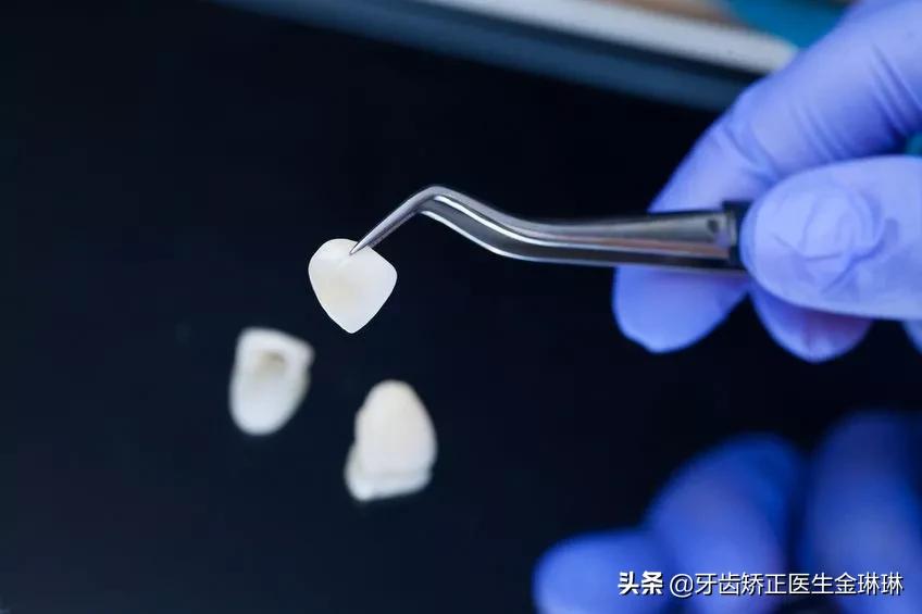 诺尔口腔牙齿矫正怎么样,淄博诺尔漫口腔