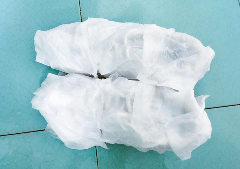 小白鞋发黄也别扔教你一招变新,小白鞋变黄了怎么变白教程