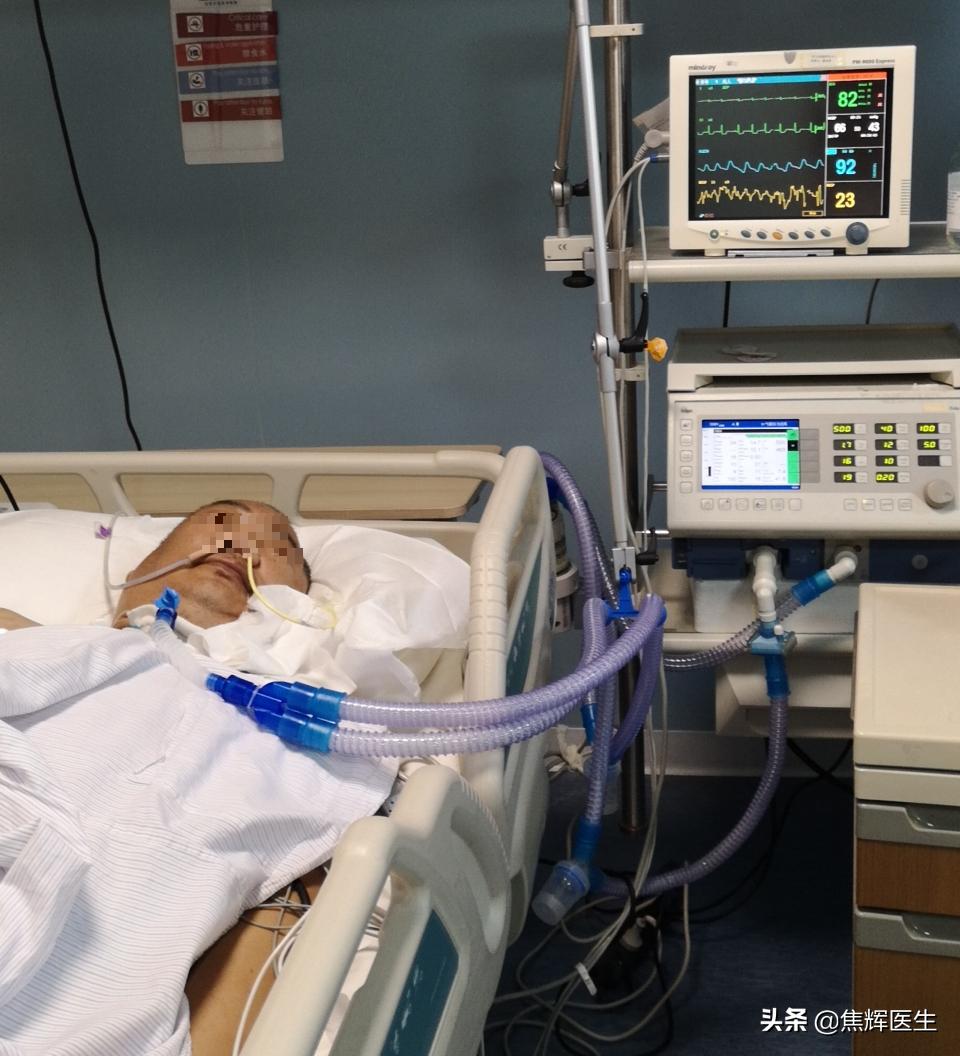 脑干出血最好的自己锻炼方法,怎么快速让脑干出血康复治愈