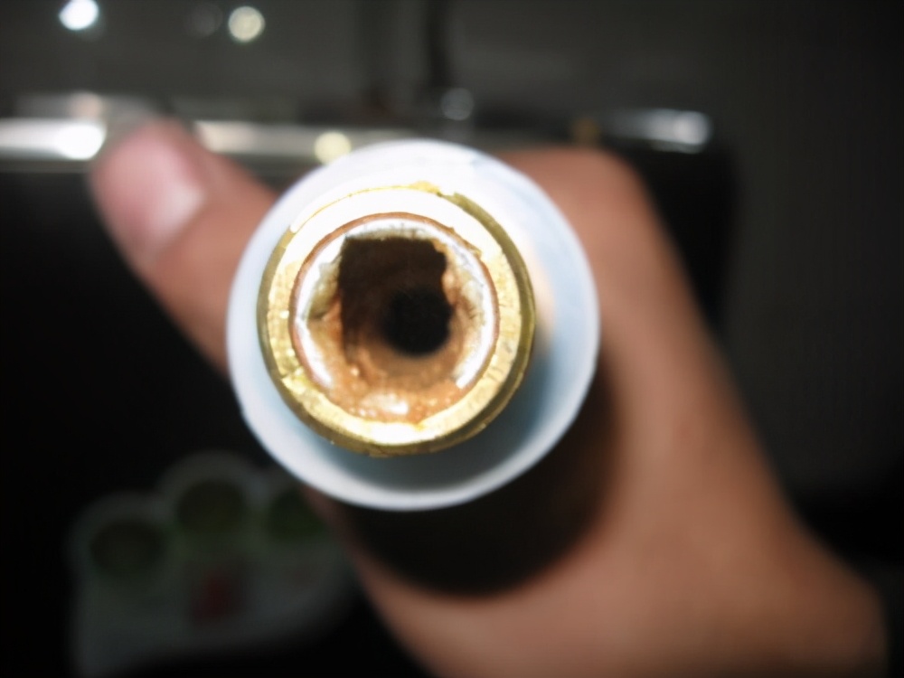 天生颈动脉狭窄怎么办,体检发现血管狭窄怎么办