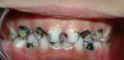 你的牙齿变黄了怎么办,你的牙齿为什么会那么白