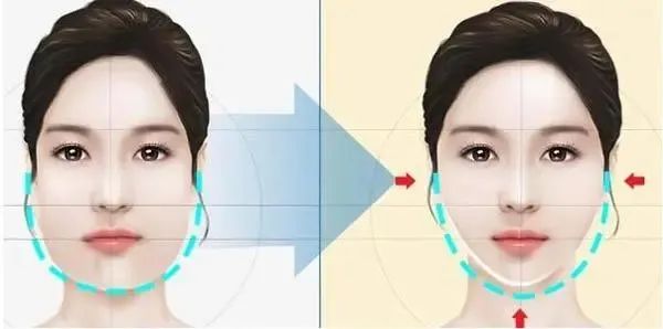 脸腮部又胖了,脸越来越胖脖子越来越粗