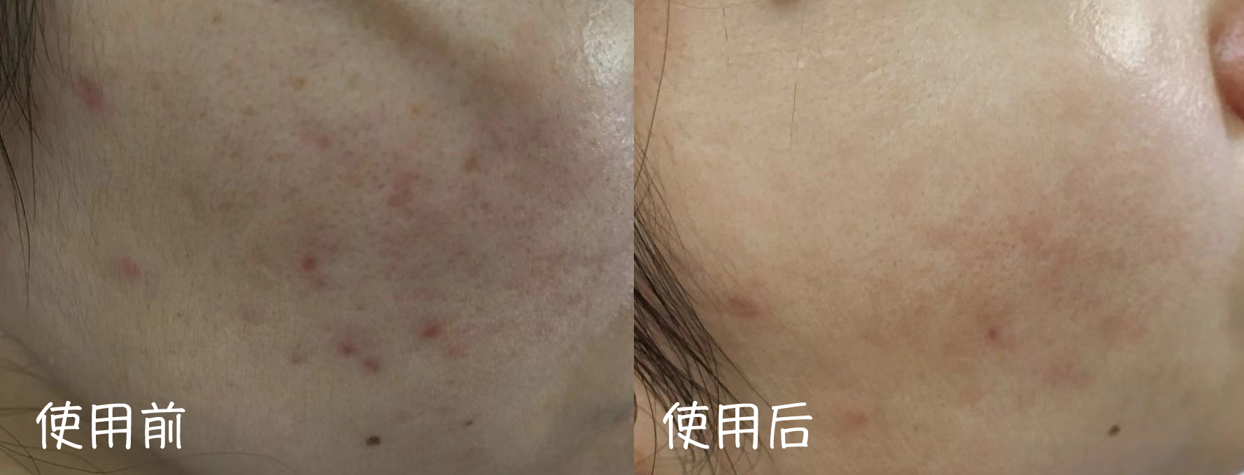 国货修护祛痘印护肤品推荐,堪比大牌平价护肤品