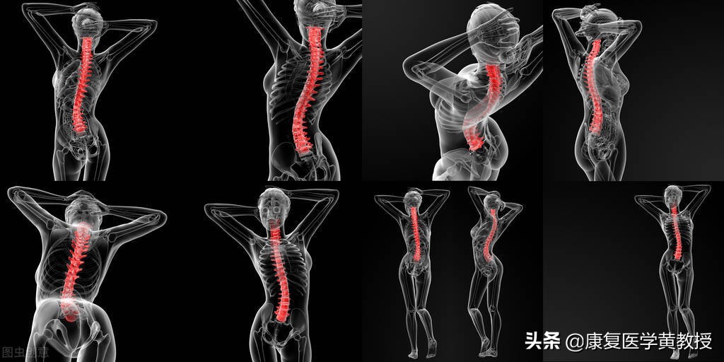 颈椎病中医能彻底治好吗,颈椎病中医能治吗