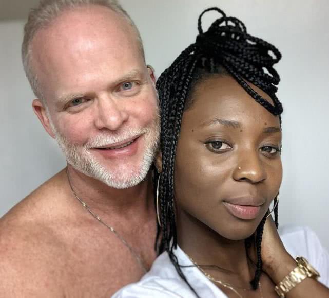 26岁女子治疗脱发,尿液治脱发