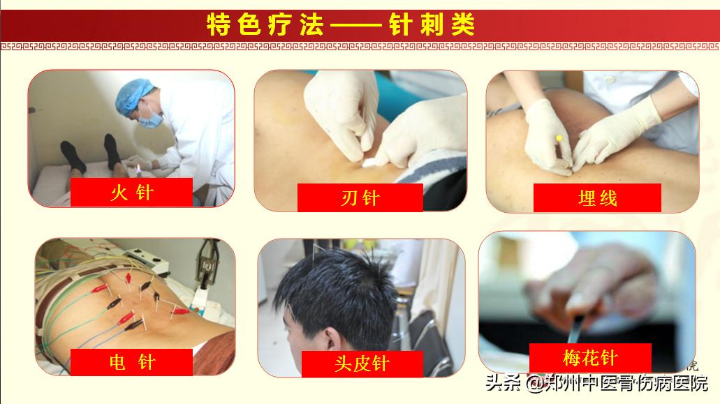 受了工伤要多久去做工伤鉴定,工伤什么情况下有工伤康复费