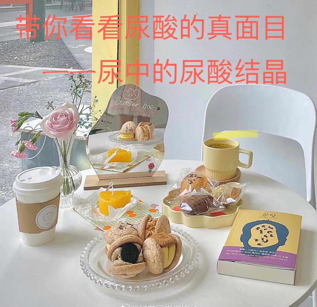 看尿酸化验单,检查尿酸600以上的图片