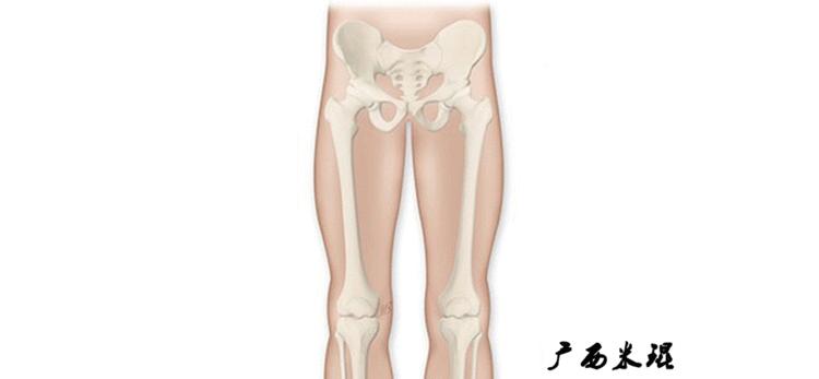 广西骨科医生米琨最新信息,米琨广西骨科什么水平